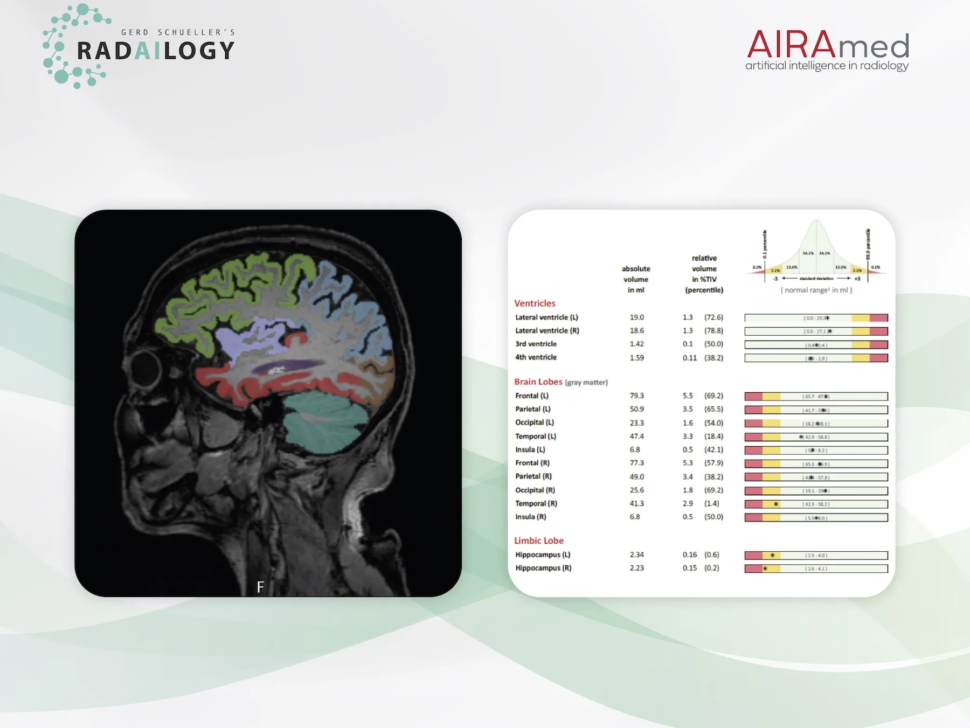 AiraMed copy