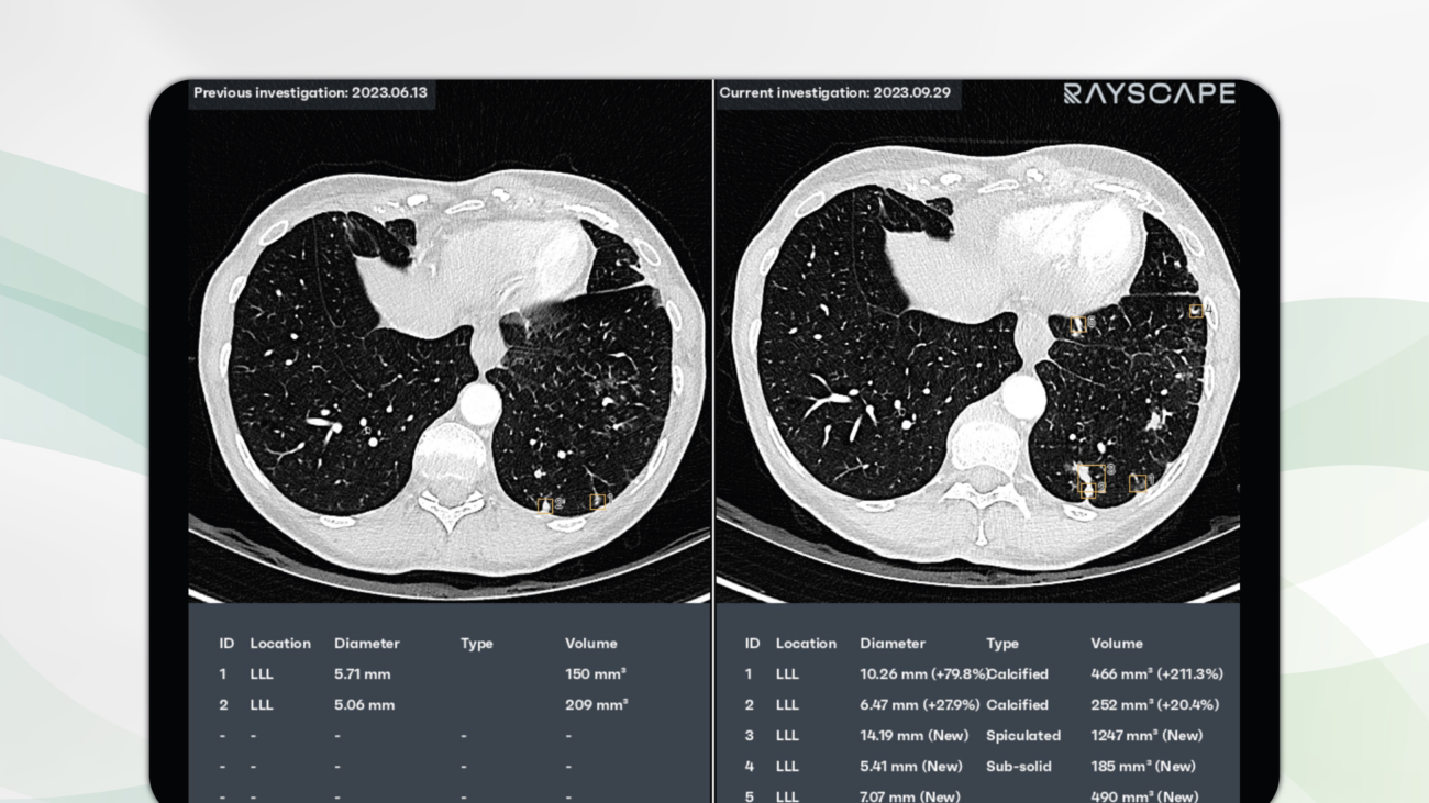 RayscapeLungCT