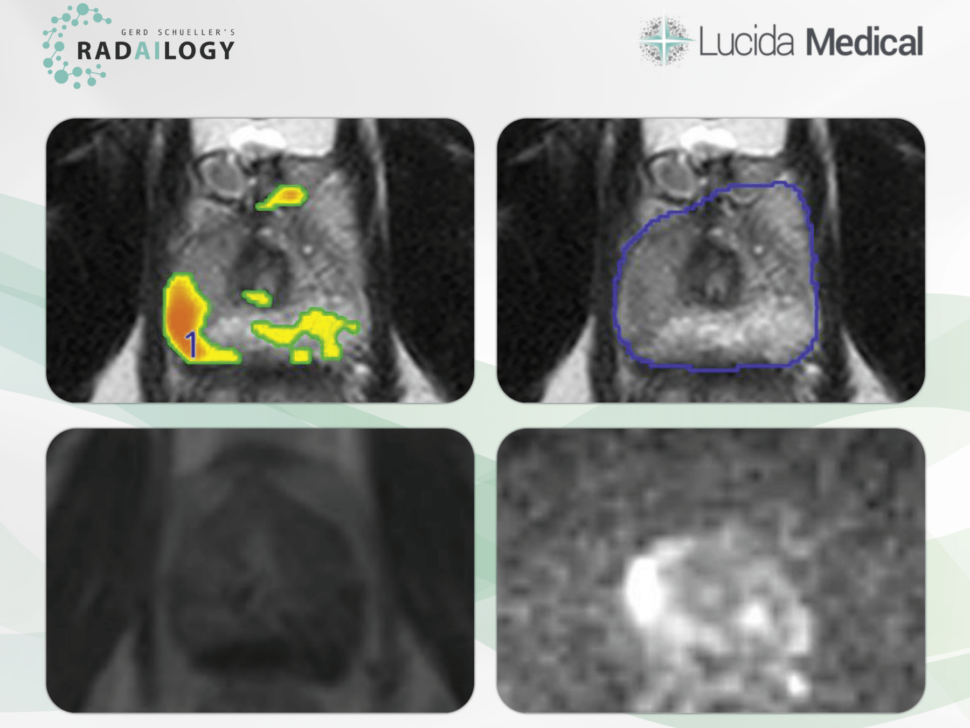 LucidaMedical | AI assistant